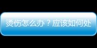 燙傷怎么辦？應該如何處理？