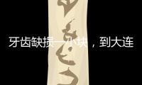 牙齒缺損一小塊，到大連齒醫(yī)生口腔修補(bǔ)牙齒需要多少錢(qián)？