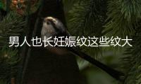 男人也長(zhǎng)妊娠紋這些紋大人小孩都可能會(huì)長(zhǎng)