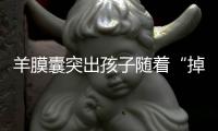 羊膜囊突出孩子隨著“掉”出來，罪魁禍首是這3個原因