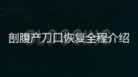 剖腹產刀口恢復全程介紹圖解