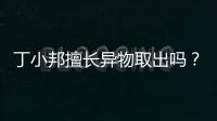 丁小邦擅長異物取出嗎？注射物/山根異物取出做得好價格不貴