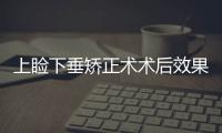 上瞼下垂矯正術術后效果