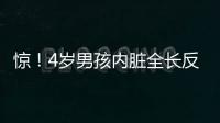 驚！4歲男孩內臟全長反成“鏡面人”