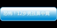 恐怖！12歲男孩鼻中竟然有10多根木屑