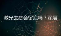 激光去痣會留疤嗎？深層去痣必然會留疤