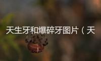 天生牙和爆碎牙圖片（天生牙 爆碎牙 鐵碎牙有什么不同 別說廢話）