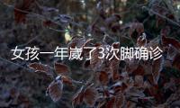 女孩一年崴了3次腳確診骨折 首次扭傷需重視