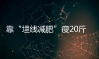 靠“埋線減肥”瘦20斤？真相在這里！