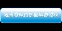 韓國發現首例猴痘疑似病例