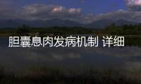 膽囊息肉發病機制 詳細說明膽囊息肉7個疑問