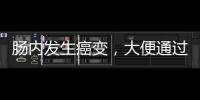 腸內發生癌變，大便通過4種“異常信息”告知，最好做腸鏡確定