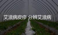 艾滋病皮疹 分辨艾滋病皮疹和普通皮疹