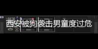 西安被狗襲擊男童度過危險期 家屬尋求法律援助