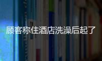 顧客稱住酒店洗澡后起了一身疙瘩 發現花灑里全是雜質