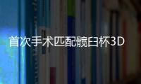 首次手術匹配髖臼杯3D打印種植體