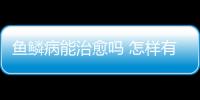 魚鱗病能治愈嗎 怎樣有效的治療魚鱗病