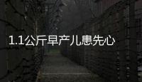 1.1公斤早產兒患先心病 “鴿子蛋”上醫生施妙手